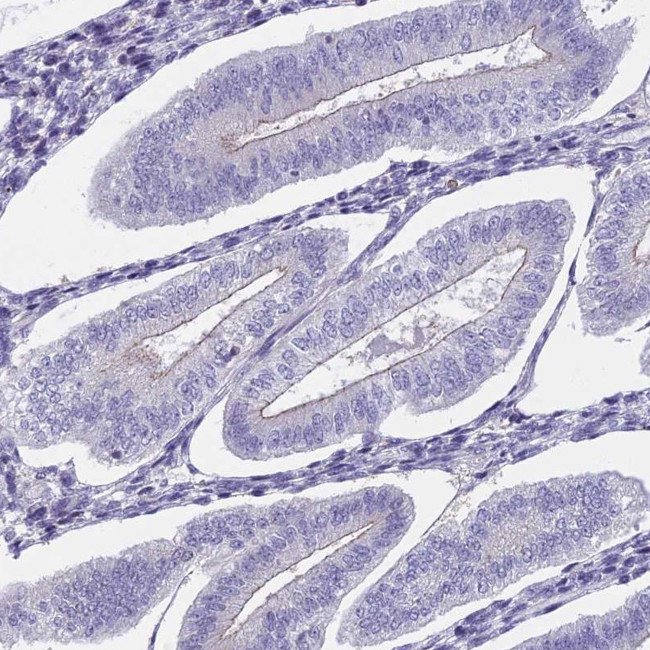 ECE2 Antibody in Immunohistochemistry (Paraffin) (IHC (P))
