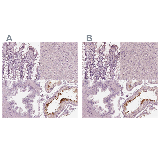 Calreticulin 3 Antibody in Immunohistochemistry (Paraffin) (IHC (P))