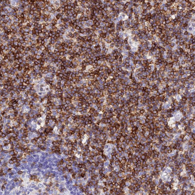 CD5 Antibody in Immunohistochemistry (Paraffin) (IHC (P))
