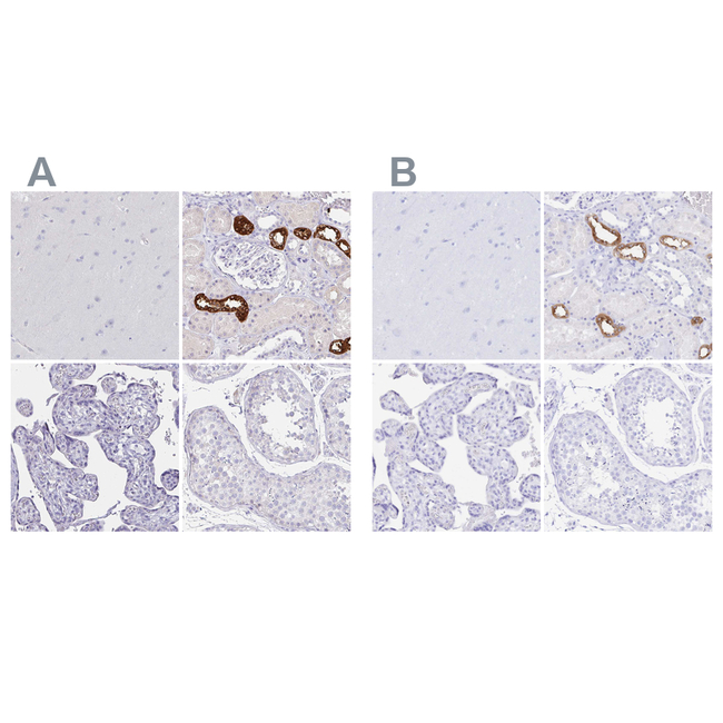 Uromodulin Antibody in Immunohistochemistry (Paraffin) (IHC (P))
