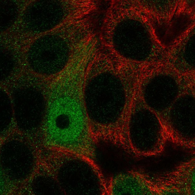 AP5S1 Antibody in Immunocytochemistry (ICC/IF)