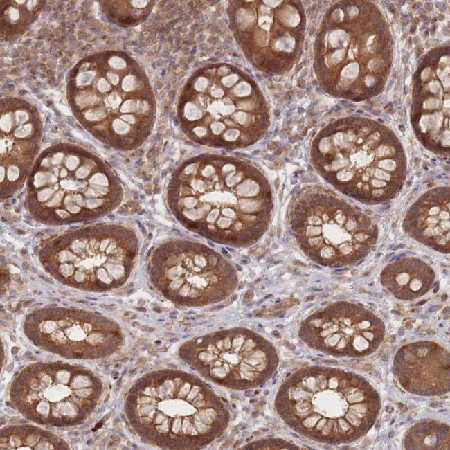 GLE1 Antibody in Immunohistochemistry (Paraffin) (IHC (P))