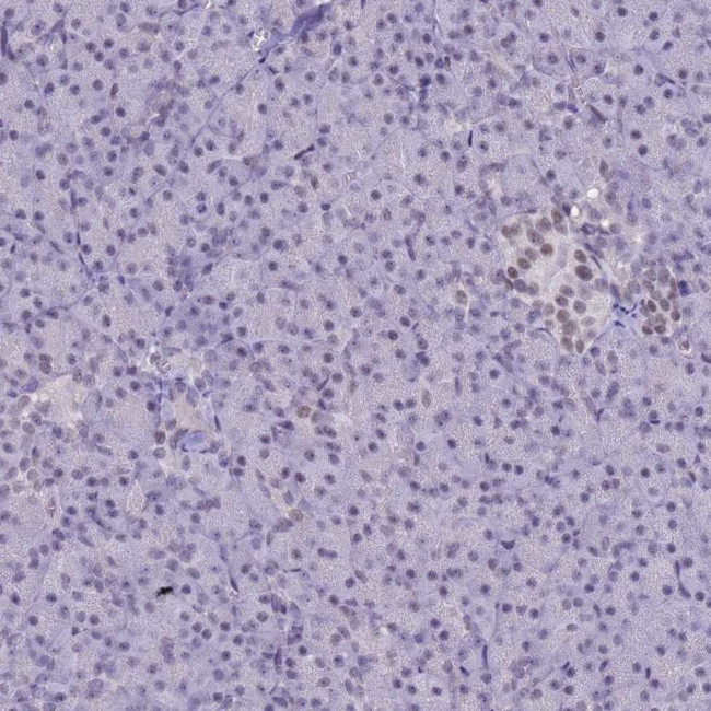 SAE1 Antibody in Immunohistochemistry (Paraffin) (IHC (P))
