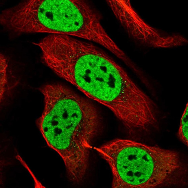 RALY Antibody in Immunocytochemistry (ICC/IF)