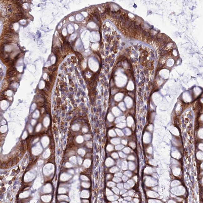 LNPEP Antibody in Immunohistochemistry (Paraffin) (IHC (P))