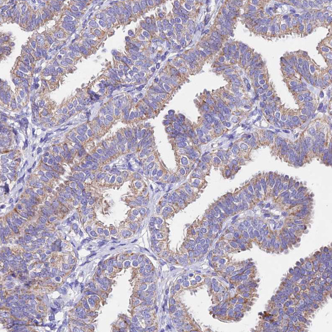 MRPL3 Antibody in Immunohistochemistry (Paraffin) (IHC (P))