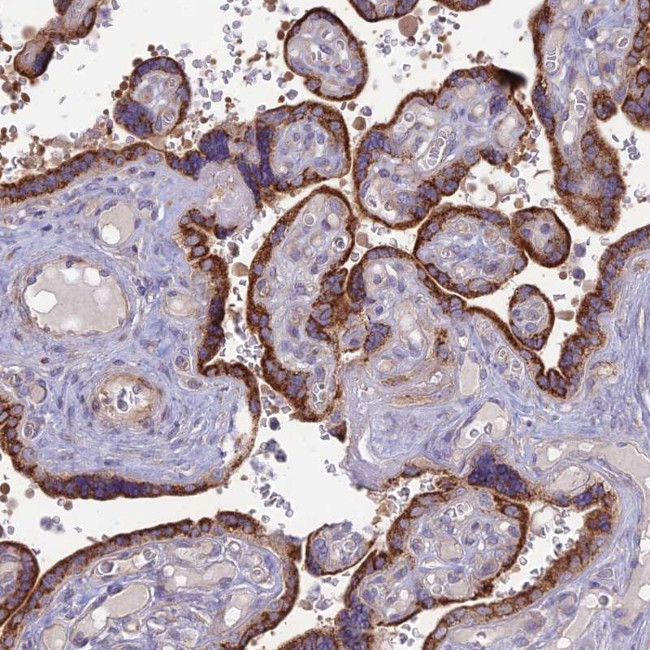 PTCD2 Antibody in Immunohistochemistry (Paraffin) (IHC (P))
