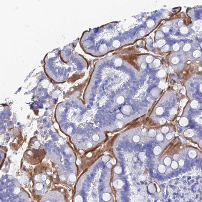 CD203c Antibody in Immunohistochemistry (Paraffin) (IHC (P))