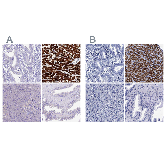 MYBPC3 Antibody in Immunohistochemistry (Paraffin) (IHC (P))