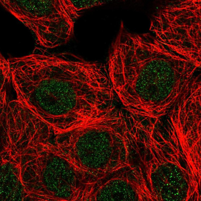 PLCB3 Antibody in Immunocytochemistry (ICC/IF)