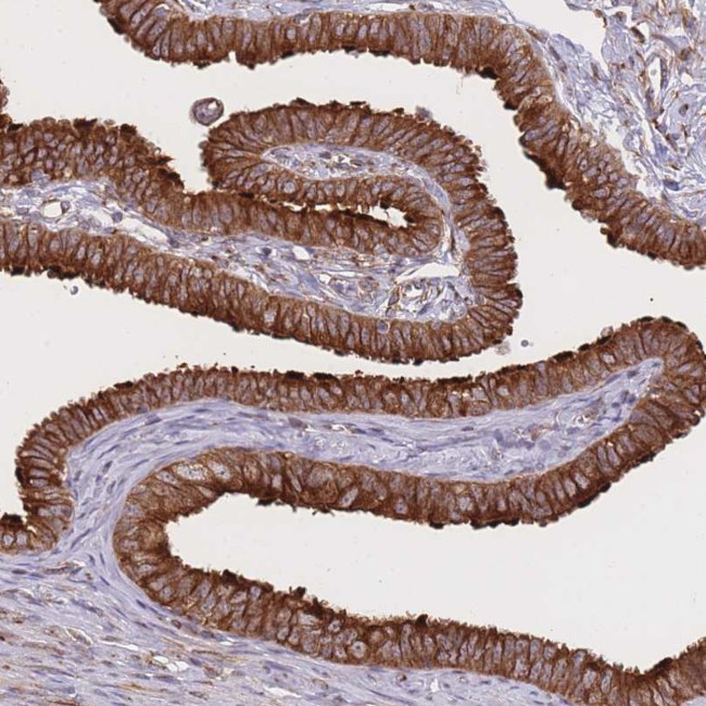 EXOSC8 Antibody in Immunohistochemistry (Paraffin) (IHC (P))