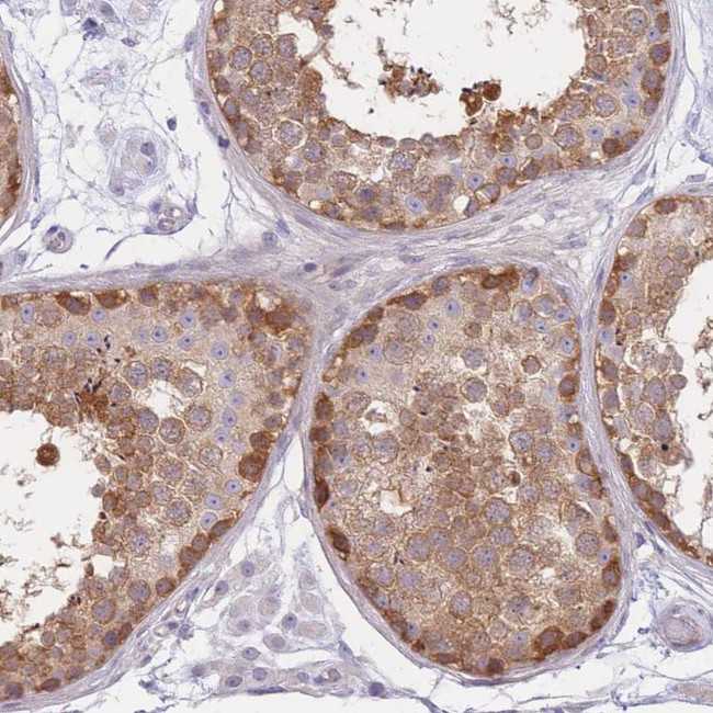 SUGT1 Antibody in Immunohistochemistry (Paraffin) (IHC (P))