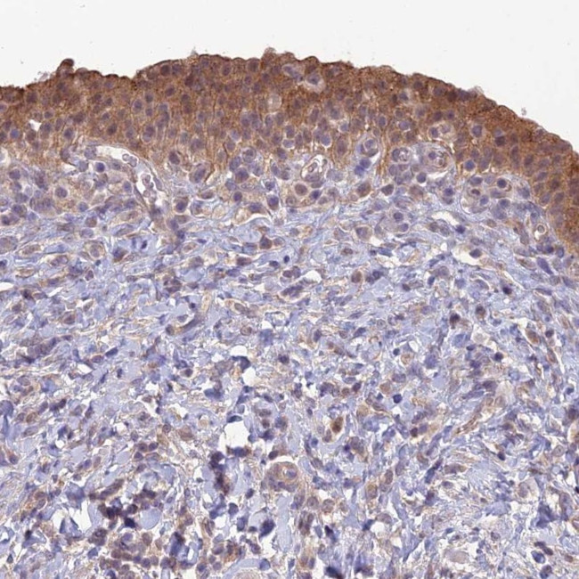 GIPC1 Antibody in Immunohistochemistry (Paraffin) (IHC (P))