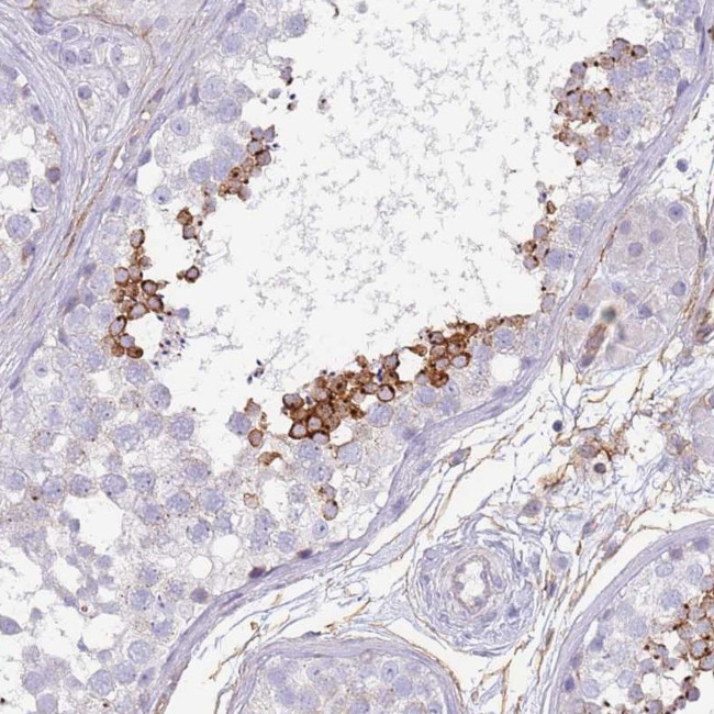 NBPF3 Antibody in Immunohistochemistry (Paraffin) (IHC (P))