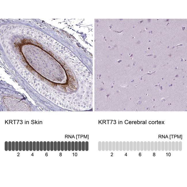 KRT73 Antibody in Immunohistochemistry (Paraffin) (IHC (P))