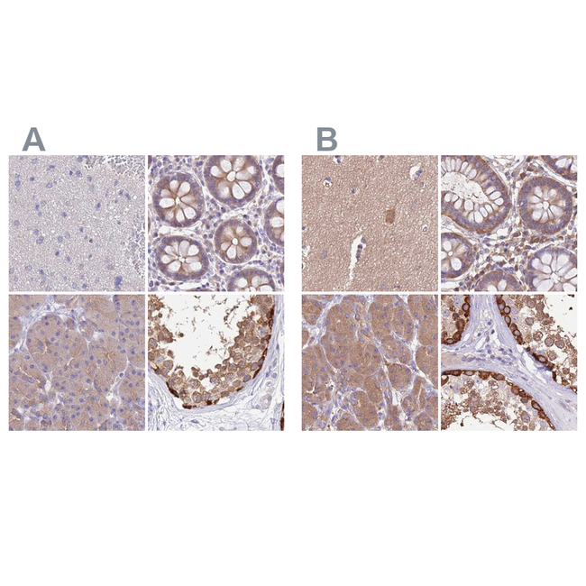 STIP1 Antibody in Immunohistochemistry (Paraffin) (IHC (P))