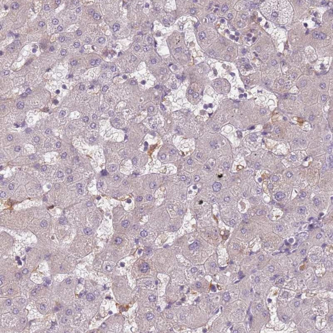 CC2D2B Antibody in Immunohistochemistry (Paraffin) (IHC (P))