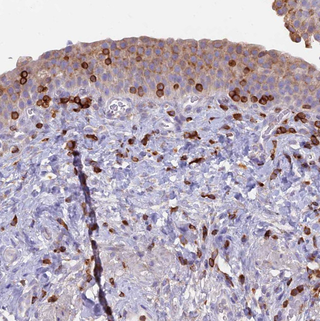 ABI3BP Antibody in Immunohistochemistry (Paraffin) (IHC (P))