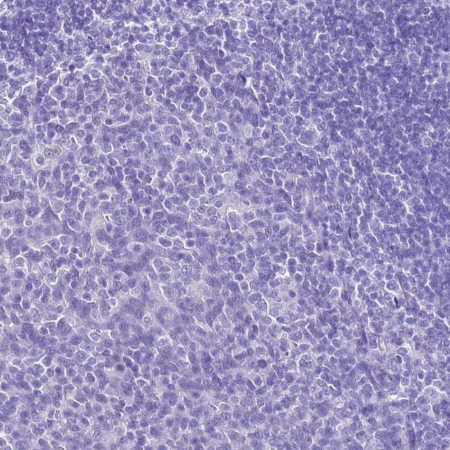 HSP20 Antibody in Immunohistochemistry (Paraffin) (IHC (P))