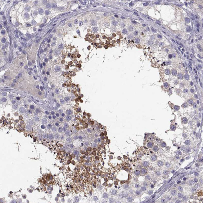ADAM32 Antibody in Immunohistochemistry (Paraffin) (IHC (P))