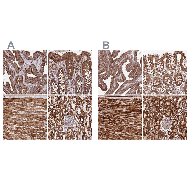 ATP5A1 Antibody in Immunohistochemistry (Paraffin) (IHC (P))