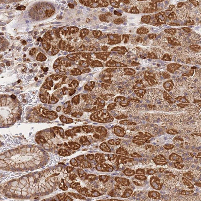 Adenylate Cyclase 9 Antibody in Immunohistochemistry (Paraffin) (IHC (P))