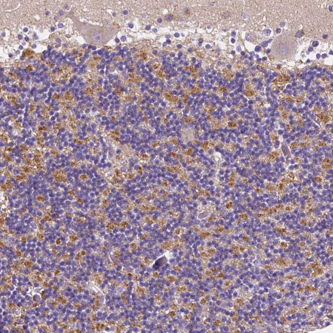 GABRD Antibody in Immunohistochemistry (Paraffin) (IHC (P))