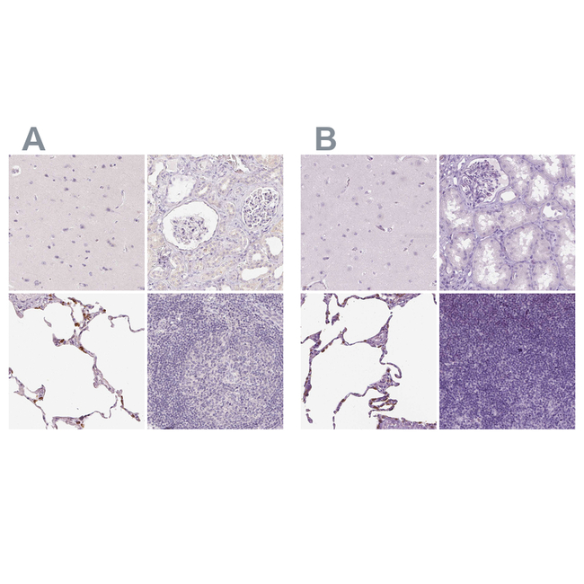 SFTPD Antibody in Immunohistochemistry (Paraffin) (IHC (P))