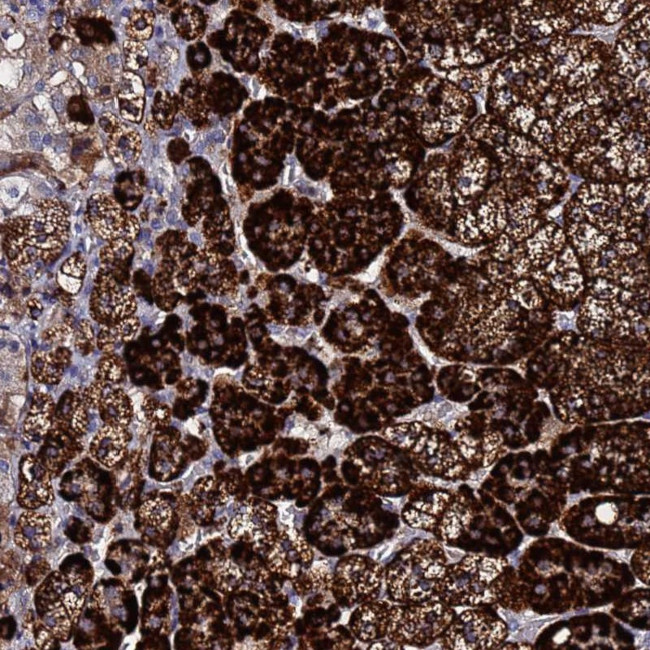 TCP10L Antibody in Immunohistochemistry (Paraffin) (IHC (P))