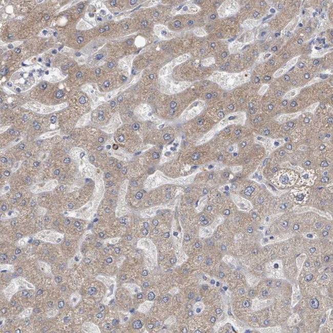 AKR1C4 Antibody in Immunohistochemistry (Paraffin) (IHC (P))