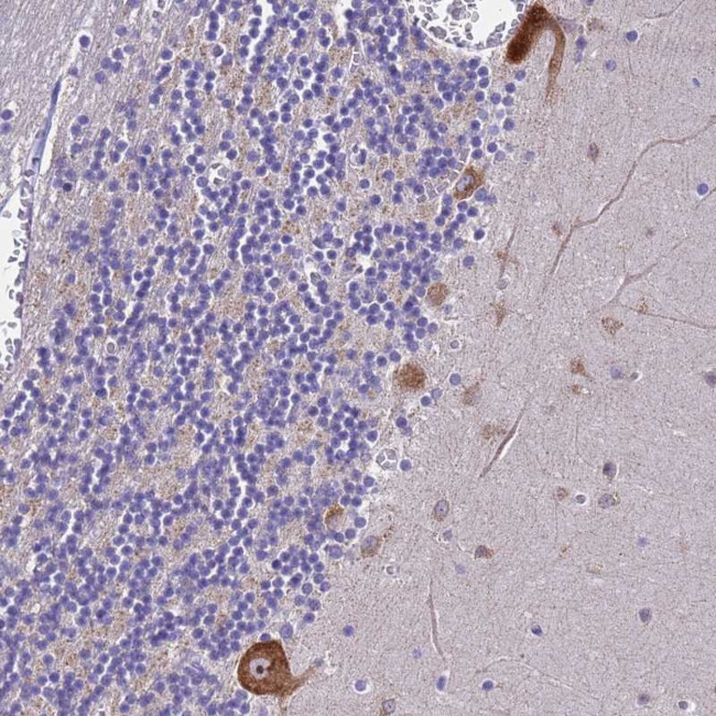 NAP1L6 Antibody in Immunohistochemistry (Paraffin) (IHC (P))