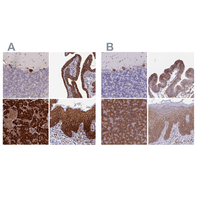 RPL8 Antibody in Immunohistochemistry (Paraffin) (IHC (P))