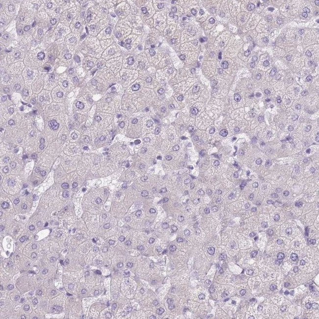 TMEM236 Antibody in Immunohistochemistry (Paraffin) (IHC (P))