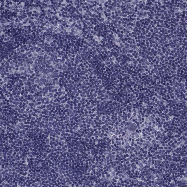 PDE6H Antibody in Immunohistochemistry (Paraffin) (IHC (P))