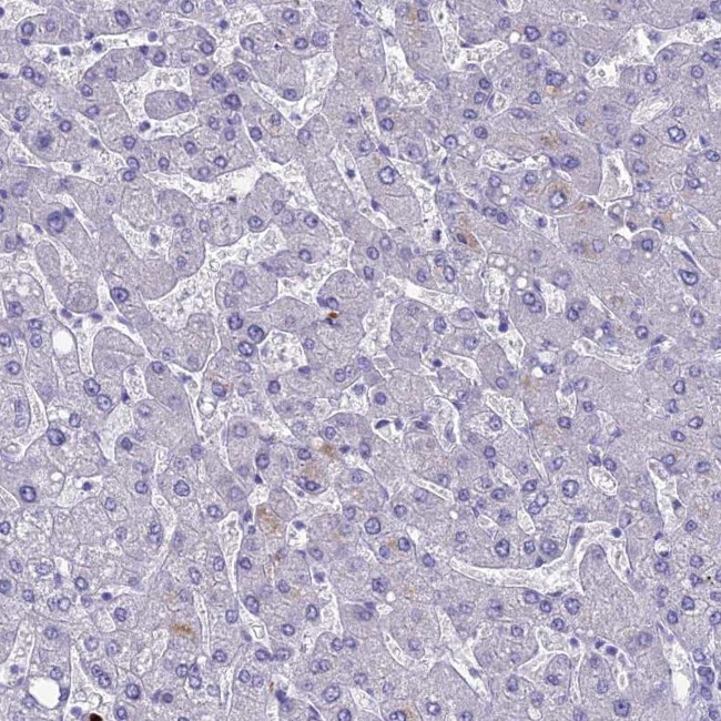 MUC13 Antibody in Immunohistochemistry (Paraffin) (IHC (P))