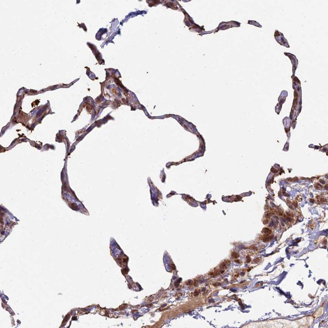 MOX1 Antibody in Immunohistochemistry (Paraffin) (IHC (P))