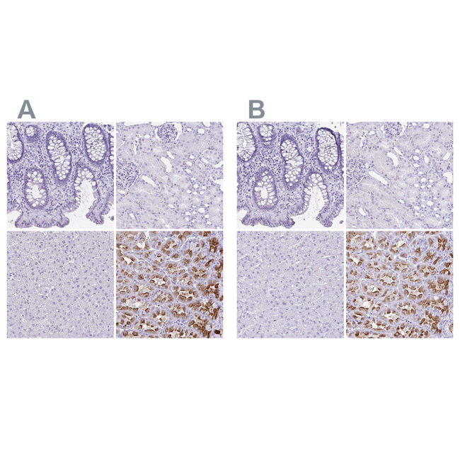 ATP4B Antibody in Immunohistochemistry (Paraffin) (IHC (P))