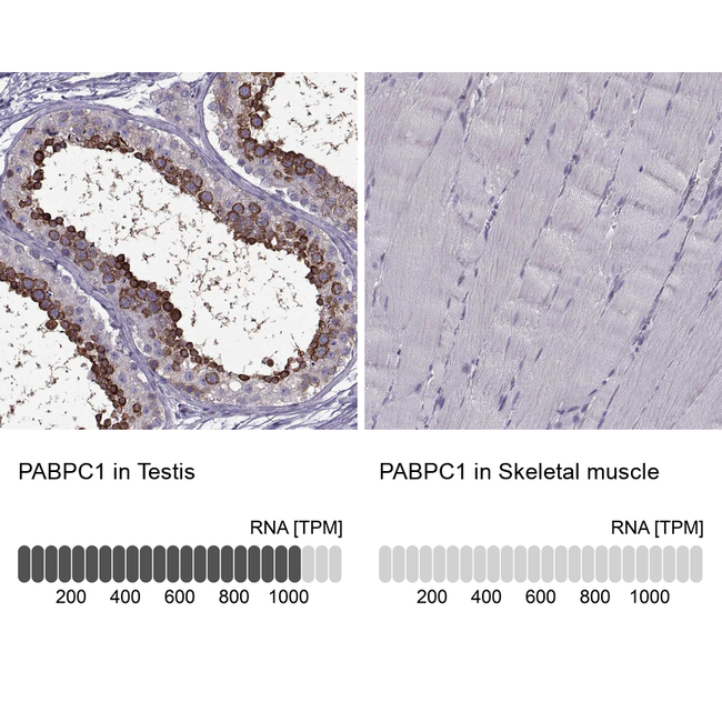 PABPC1 Antibody in Immunohistochemistry (Paraffin) (IHC (P))