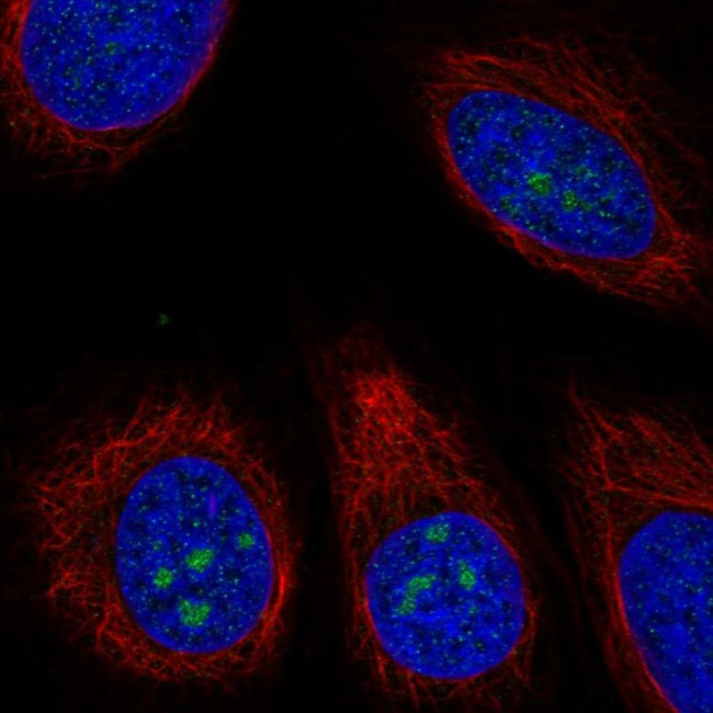 TMEM217 Antibody in Immunocytochemistry (ICC/IF)