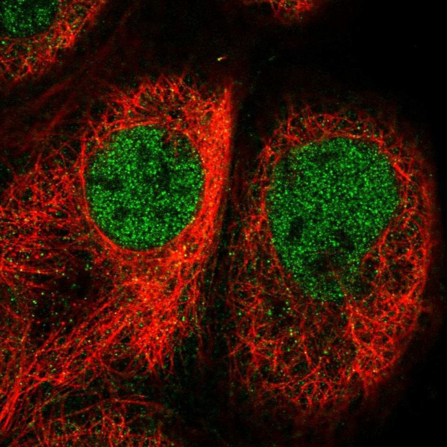 Cofilin 2 Antibody in Immunocytochemistry (ICC/IF)