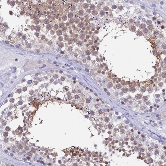 DEFB107A Antibody in Immunohistochemistry (Paraffin) (IHC (P))