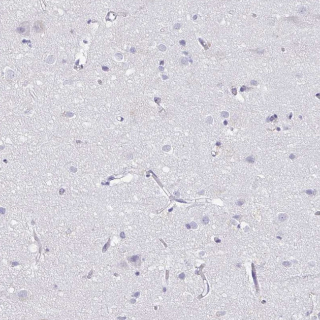 PGRP-S Antibody in Immunohistochemistry (Paraffin) (IHC (P))