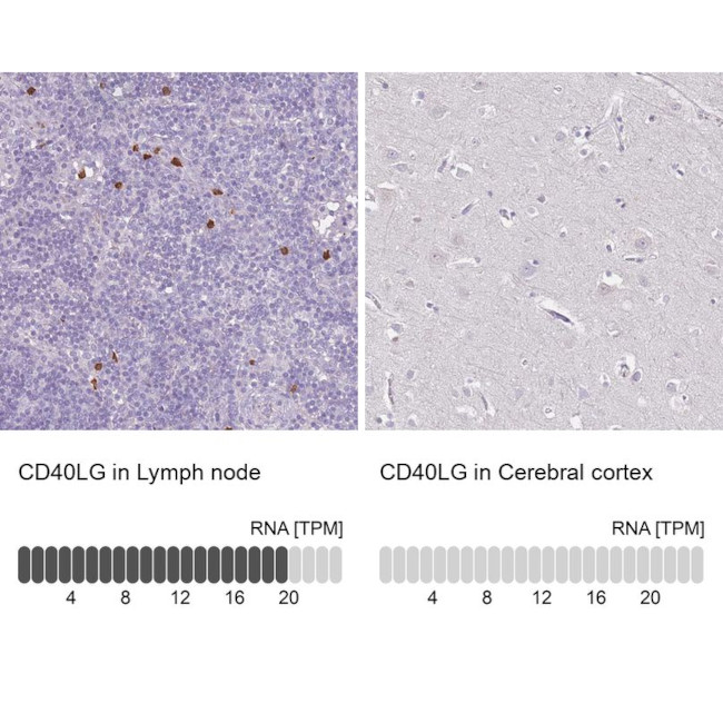 CD154 (CD40 Ligand) Antibody