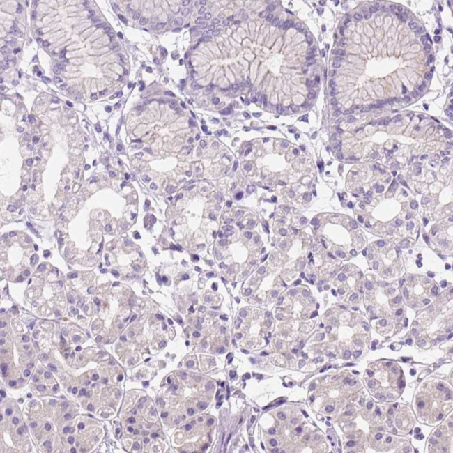 Claudin 17 Antibody in Immunohistochemistry (Paraffin) (IHC (P))