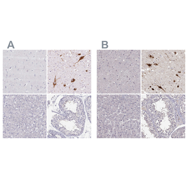 PMCH Antibody in Immunohistochemistry (Paraffin) (IHC (P))