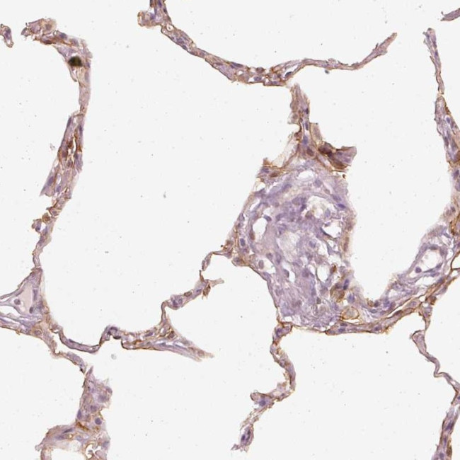 DAPP1 Antibody in Immunohistochemistry (Paraffin) (IHC (P))