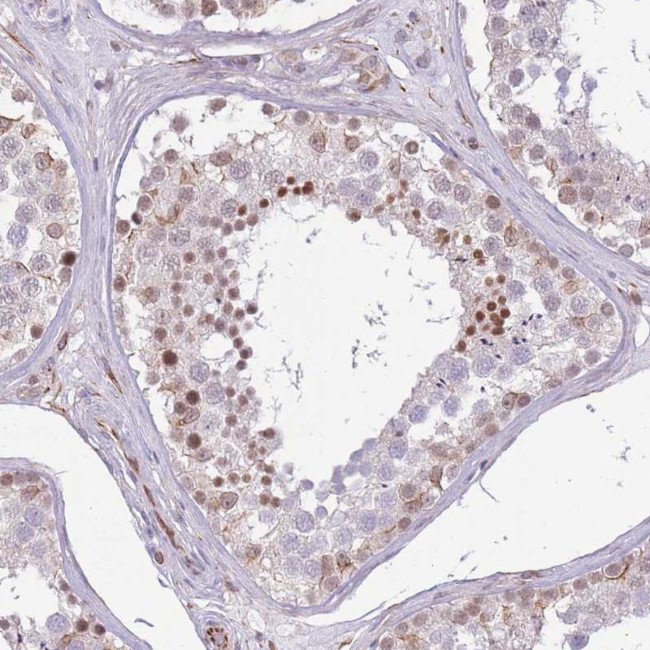 ELL Antibody in Immunohistochemistry (Paraffin) (IHC (P))