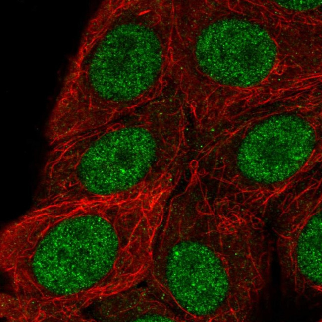 RSF1 Antibody in Immunocytochemistry (ICC/IF)