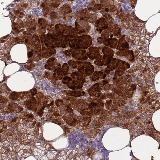 RSPO1 Antibody in Immunohistochemistry (Paraffin) (IHC (P))