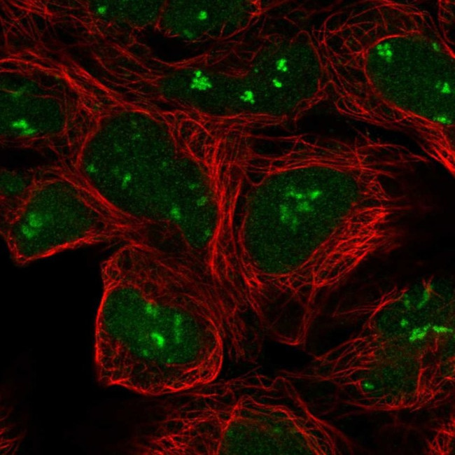 A-Raf Antibody in Immunocytochemistry (ICC/IF)